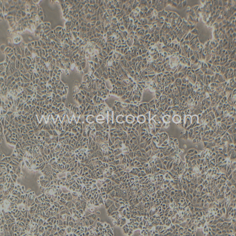 MCF7-LUC示蹤穩(wěn)定細(xì)胞株（STR鑒定正確）