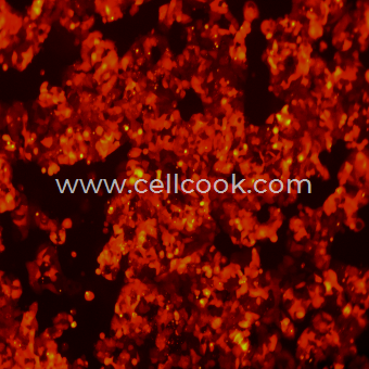 MCF7-RFP示蹤穩(wěn)定細(xì)胞株（STR鑒定正確）