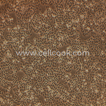 MDA-MB-468人乳腺癌細(xì)胞（STR鑒定正確）