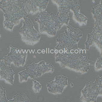 BT-474人乳腺導(dǎo)管瘤細(xì)胞（STR鑒定正確）