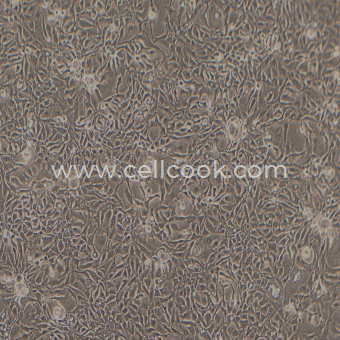 BT-20人乳腺癌細胞（STR鑒定正確）