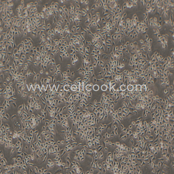 HCC1806人乳腺癌細胞（STR鑒定正確）