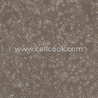 JIMT-1人乳腺癌細胞（STR鑒定正確）