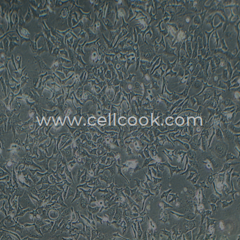 HCC1954人乳腺導(dǎo)管癌細胞（STR鑒定正確）