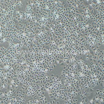 AGS人胃腺癌細胞（STR鑒定正確）