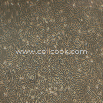 HGC-27人胃癌細胞（STR鑒定正確）