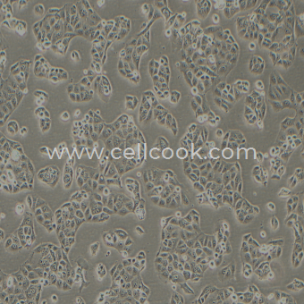 MKN28（MKN74）人胃癌細胞（STR鑒定正確）