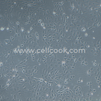 SNU-216人胃癌細胞（淋巴轉(zhuǎn)移）（STR鑒定正確）