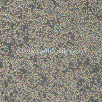 MKN45人胃癌細(xì)胞（STR鑒定正確）