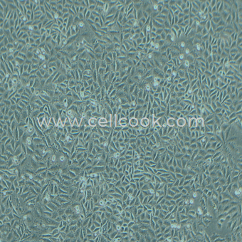 SNU-668人胃癌細(xì)胞（STR鑒定正確）