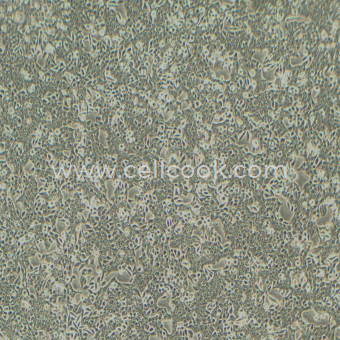 SW620人結(jié)腸癌細(xì)胞（STR鑒定正確）