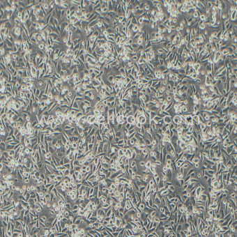 SW480人結(jié)腸腺癌細(xì)胞（STR鑒定正確）