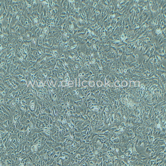 DLD1人結(jié)直腸腺癌上皮細(xì)胞（STR鑒定正確）