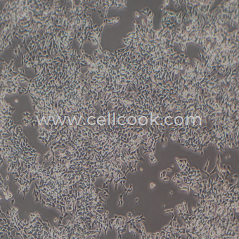 LoVo人結(jié)腸癌細(xì)胞（STR鑒定正確）