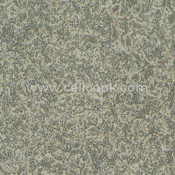 SW837人直腸腺癌細(xì)胞（STR鑒定正確）