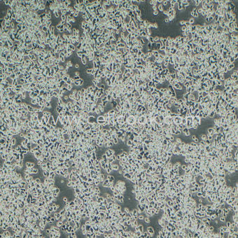 SW48人結(jié)腸腺癌細(xì)胞（STR鑒定正確）