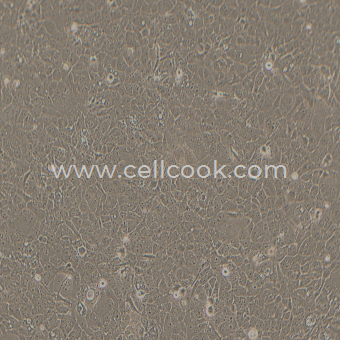 Kyse-30人食管鱗癌細(xì)胞（STR鑒定正確）