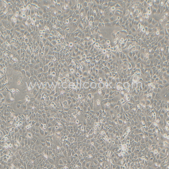 Kyse-150人食管鱗癌細(xì)胞（STR鑒定正確）