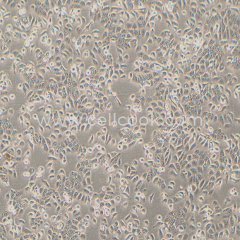 Ec109人食管鱗癌細(xì)胞（STR鑒定正確）