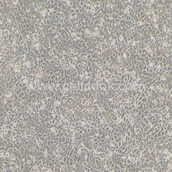 Kyse-450人食管鱗癌細(xì)胞（STR鑒定正確）