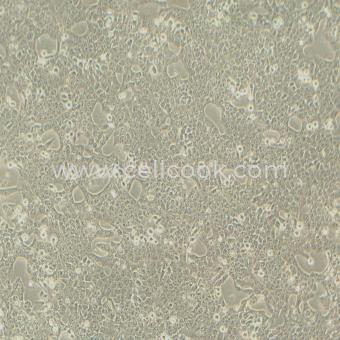 Cal-27人舌鱗癌細(xì)胞（STR鑒定正確）