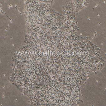 SAS人舌鱗癌細(xì)胞（STR鑒定正確）