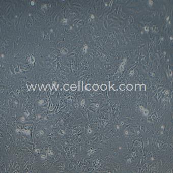 SK-OV-3-LUC示蹤穩(wěn)定細(xì)胞株（STR鑒定正確）