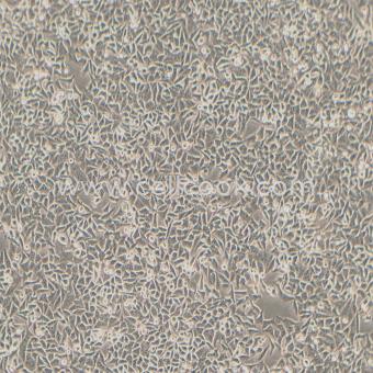 HEp-2 人喉癌細胞