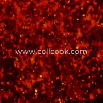 SK-OV-3-RFP示蹤穩(wěn)定細(xì)胞株（STR鑒定正確）