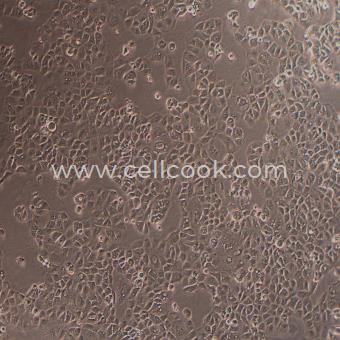 NIH/OVCAR-3人卵巢腺癌細(xì)胞（STR鑒定正確）