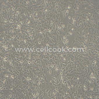 ES-2人卵巢透明細(xì)胞癌細(xì)胞（STR鑒定正確）