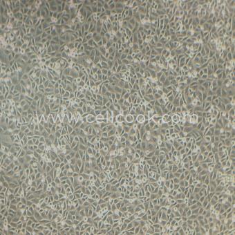 T24人膀胱移行細(xì)胞癌細(xì)胞（STR鑒定正確）