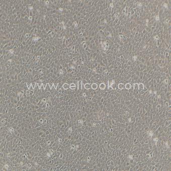 5637人膀胱癌細(xì)胞（STR鑒定正確）