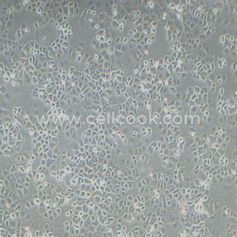 HEC-1-B人子宮內(nèi)膜腺癌細胞（STR鑒定正確）