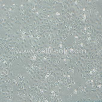 Ca ski人宮頸癌上皮細胞（STR鑒定正確）
