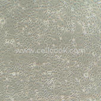 KLE人子宮內(nèi)膜腺癌細胞（STR鑒定正確）