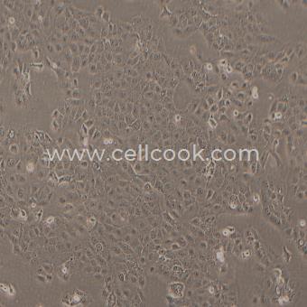 DU145人前列腺癌細胞（STR鑒定正確）