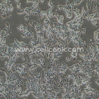 22Rv1人前列腺癌細胞（STR鑒定正確）