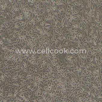 PC-3M-IE8人前列腺癌高轉(zhuǎn)移細(xì)胞株（STR鑒定正確）