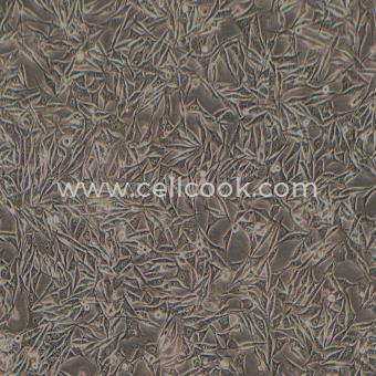 PC-3M-2B4人前列腺癌低轉(zhuǎn)移細(xì)胞株（STR鑒定正確）