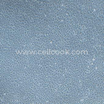 PA-1人卵巢畸胎瘤細(xì)胞（STR鑒定正確）