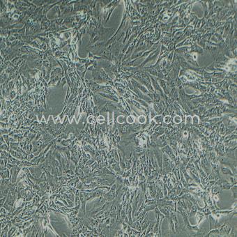 Caki-1人腎透明細(xì)胞癌皮膚轉(zhuǎn)移細(xì)胞（STR鑒定正確）