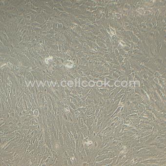 KMRC-1人腎透明細(xì)胞癌細(xì)胞(STR鑒定正確）