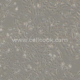 769-P人腎癌細(xì)胞（STR鑒定正確）