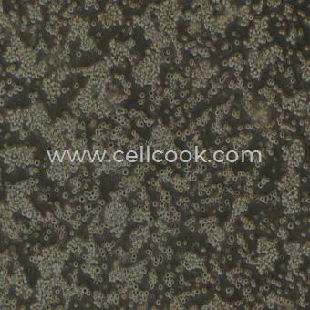 SU-DHL-2人彌漫性組織淋巴瘤細(xì)胞（STR鑒定正確）