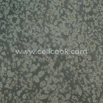 LP-1人多發(fā)性骨髓瘤細(xì)胞（STR鑒定正確）