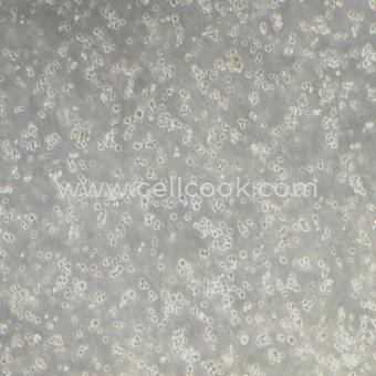 Su-DHL-6人B細(xì)胞淋巴瘤細(xì)胞（STR鑒定正確）