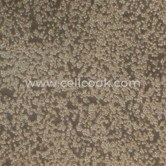 KARPAS-422人B細(xì)胞淋巴瘤細(xì)胞（STR鑒定正確）