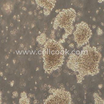 NK92人自然殺傷細(xì)胞淋巴瘤細(xì)胞（STR鑒定正確）