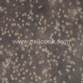 OCI-Ly19人彌漫性大B細(xì)胞淋巴瘤（STR鑒定正確）